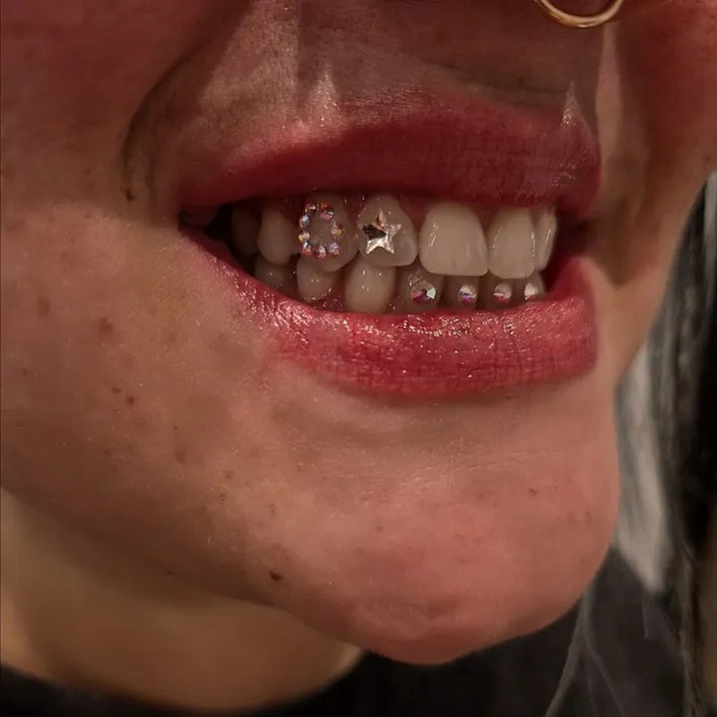 Sourire avec bijoux dentaires FlySmile