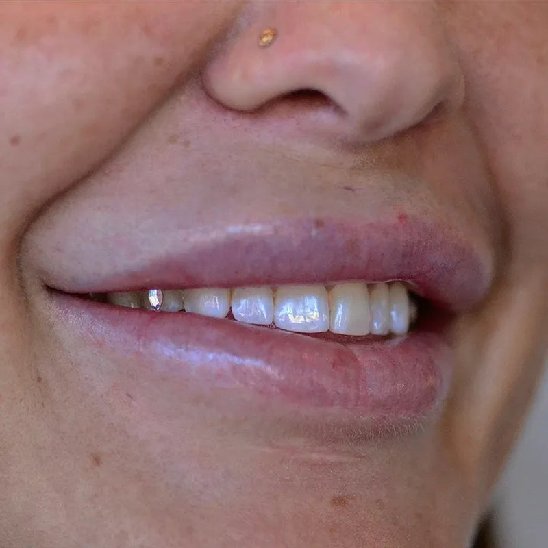 Sourire avec bijoux dentaires FlySmile