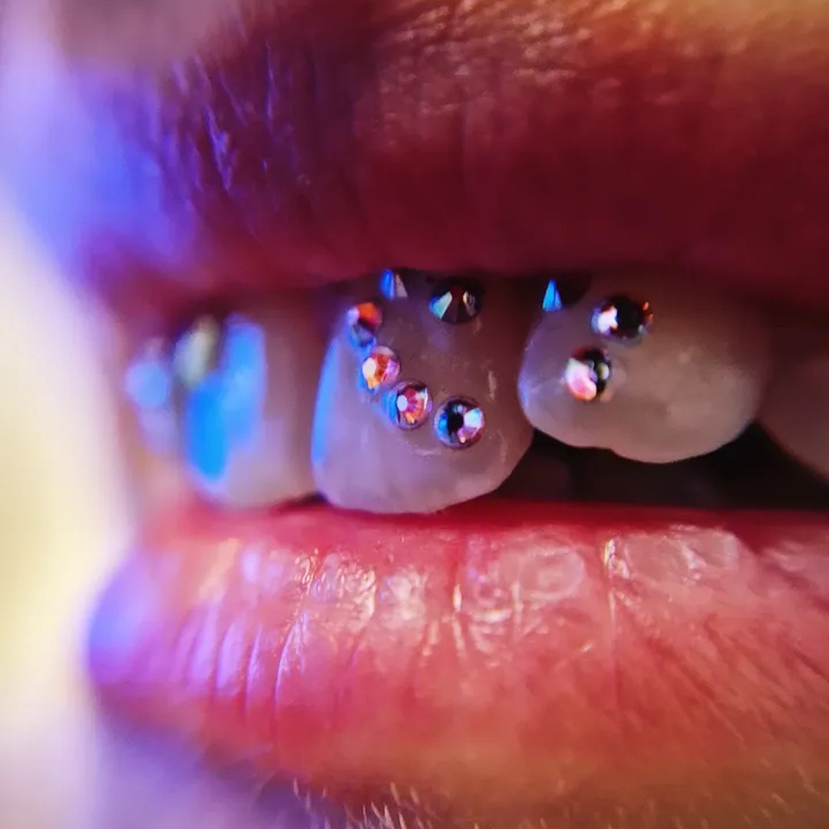 Sourire avec bijoux dentaires FlySmile