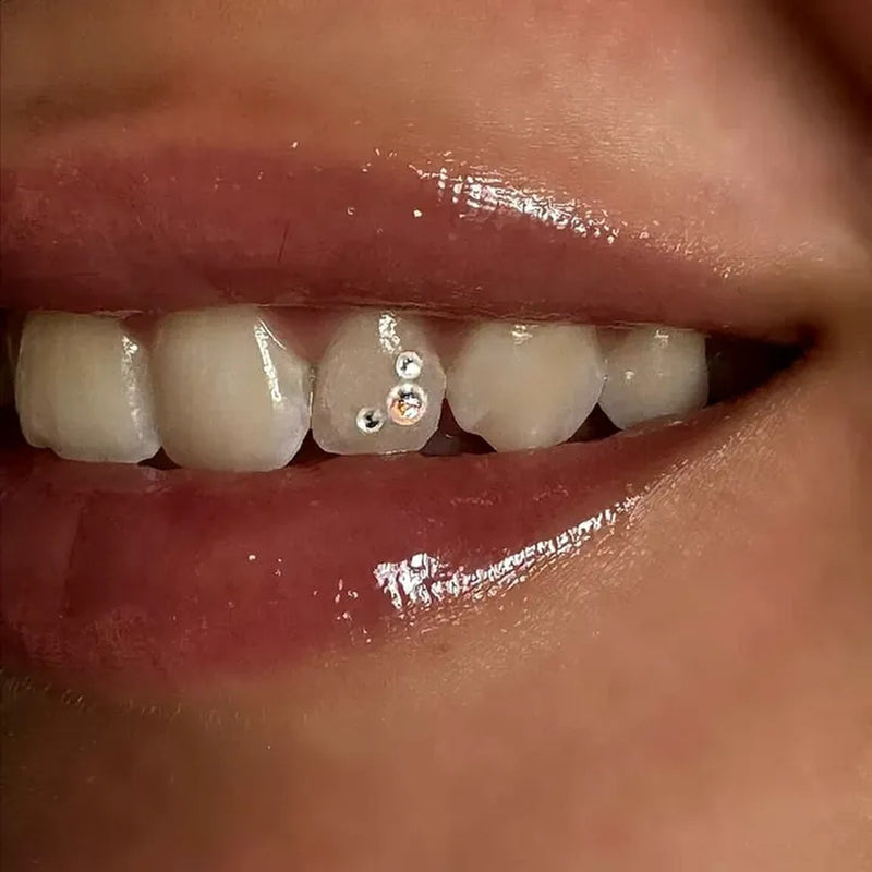 Sourire avec bijoux dentaires FlySmile