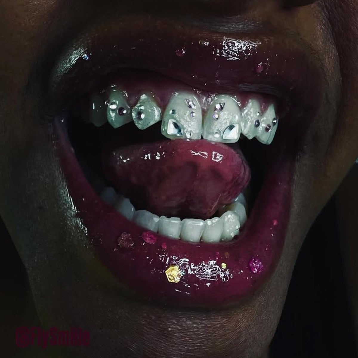 Sourire avec bijoux dentaires FlySmile