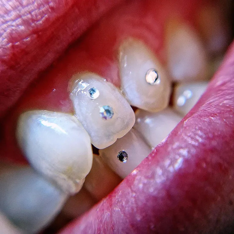 Bijoux dentaires FlySmile