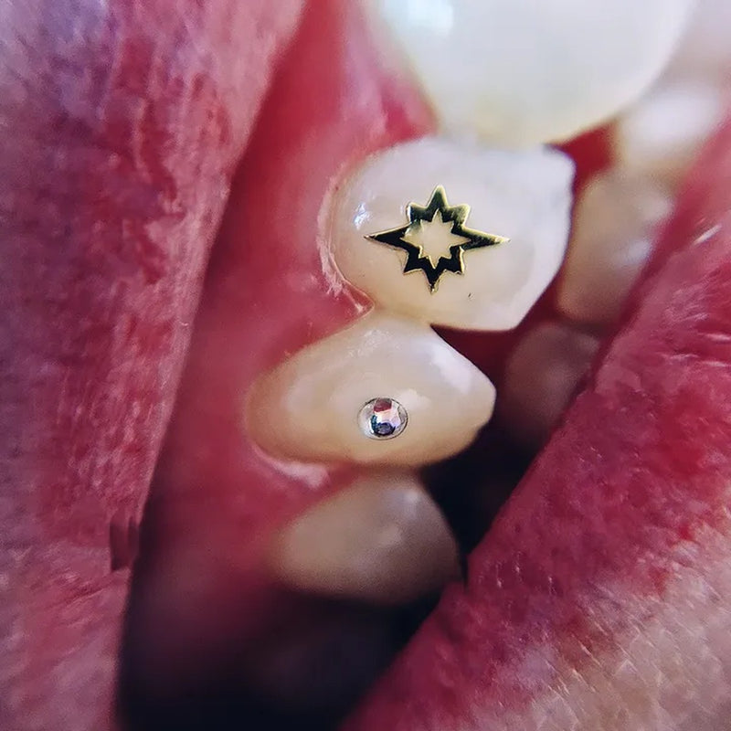 Bijoux dentaires FlySmile